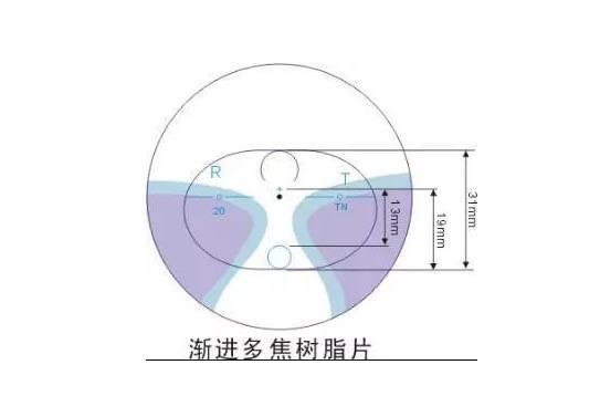 美麗島漸進(jìn)多焦鏡適合的人群，需要注意的事項(xiàng)