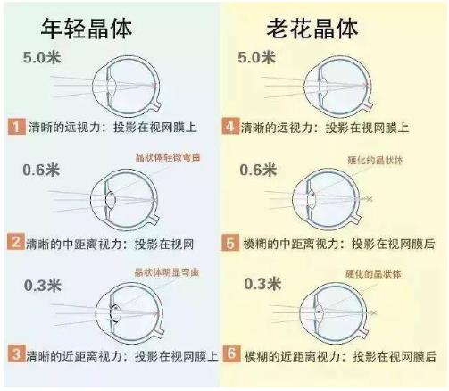 近視就不會老花了嗎？